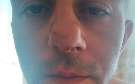 Aprel döyüşçüsü: Polislər məni huşumu itirənədək döydülər