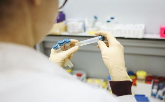 Daha bir icra başçısı koronavirusa yoluxdu