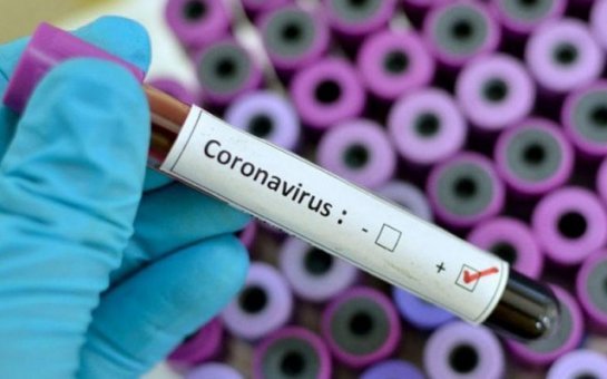 Azərbaycanda koronavirus: 526 yoluxma, 502 nəfər sağalıb