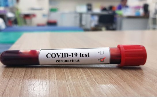 Azərbaycanda koronavirusa yoluxanların sayı bu gün də artdı