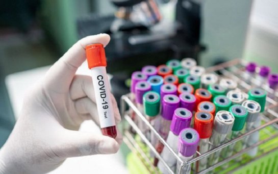 Azərbaycanda koronavirus: 119 yoluxma, 140 sağalma, 2 ölü