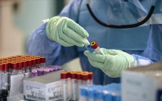 Azərbaycanda koronavirusa yoluxanların sayı 3700-ü keçdi