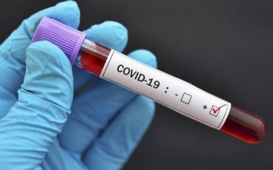 Çinin koronavirus peyvəndi Türkiyəyə gətirildi