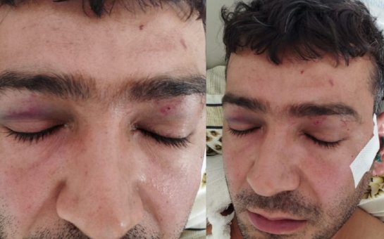 “Polislər məni ömürlük şikəstə çevirdi”